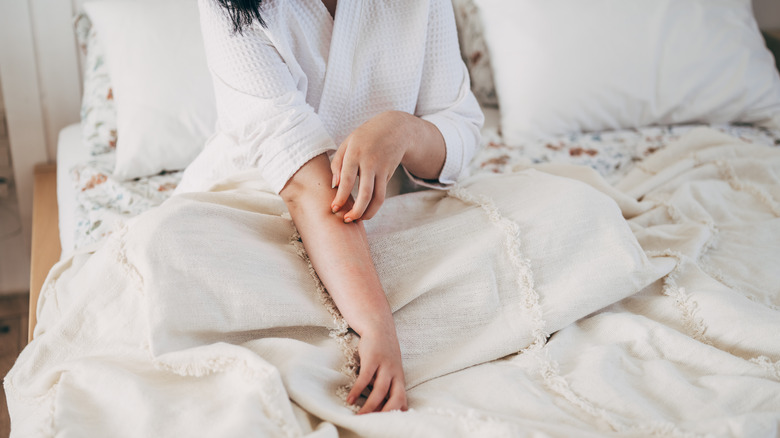 Kişi çizen sivrisinek ısırığı